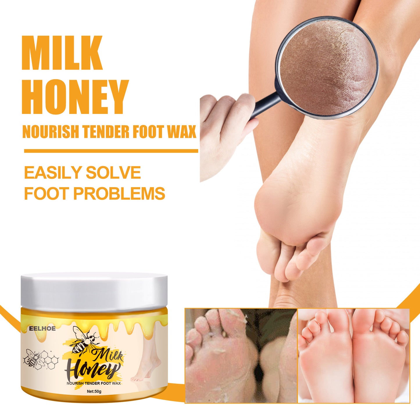 Nursing Care Of Milk Foot Wax Peeling